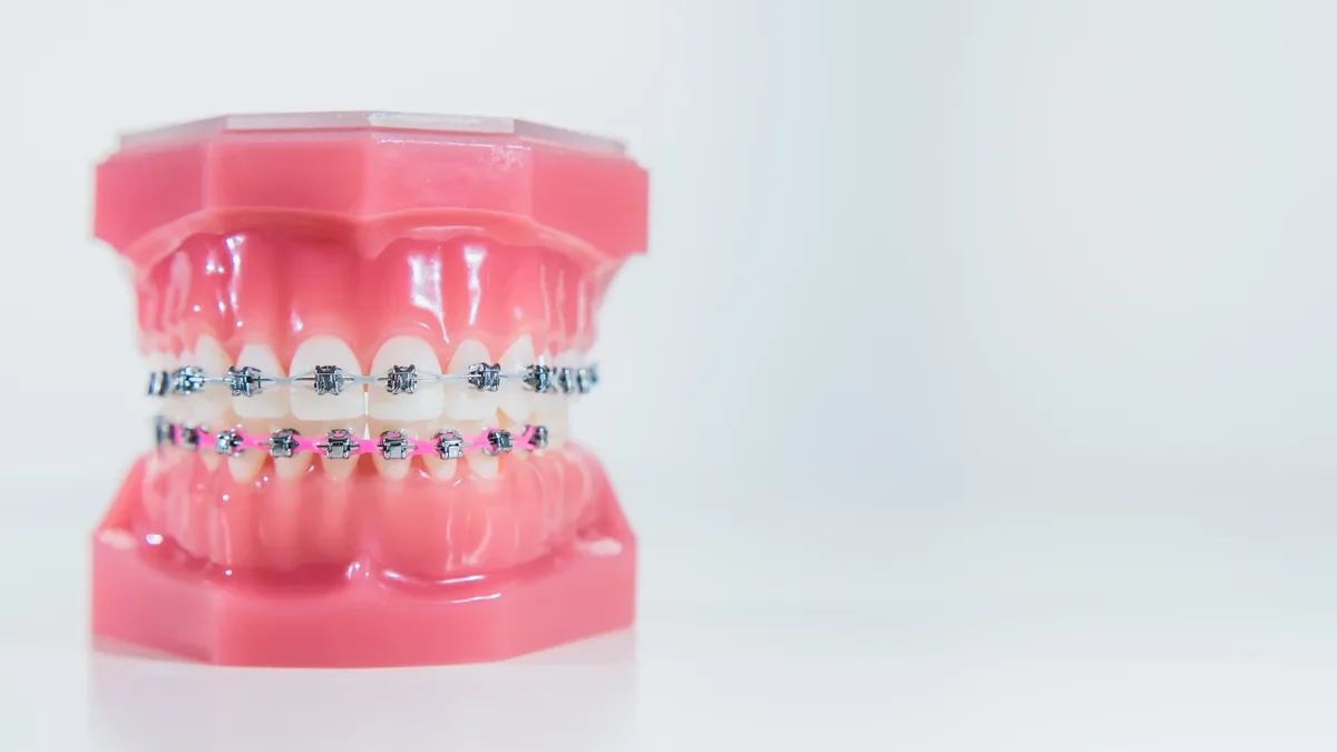 Teeth model with metal braces and coloured elastic ties on a white background