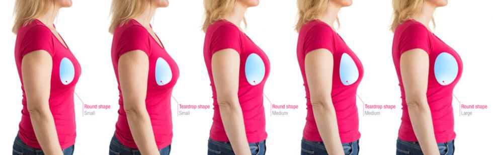 different shapes of breast