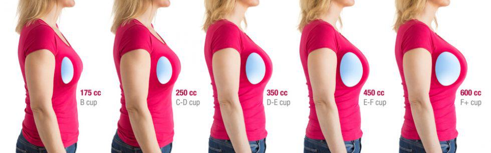 different types breast shapes