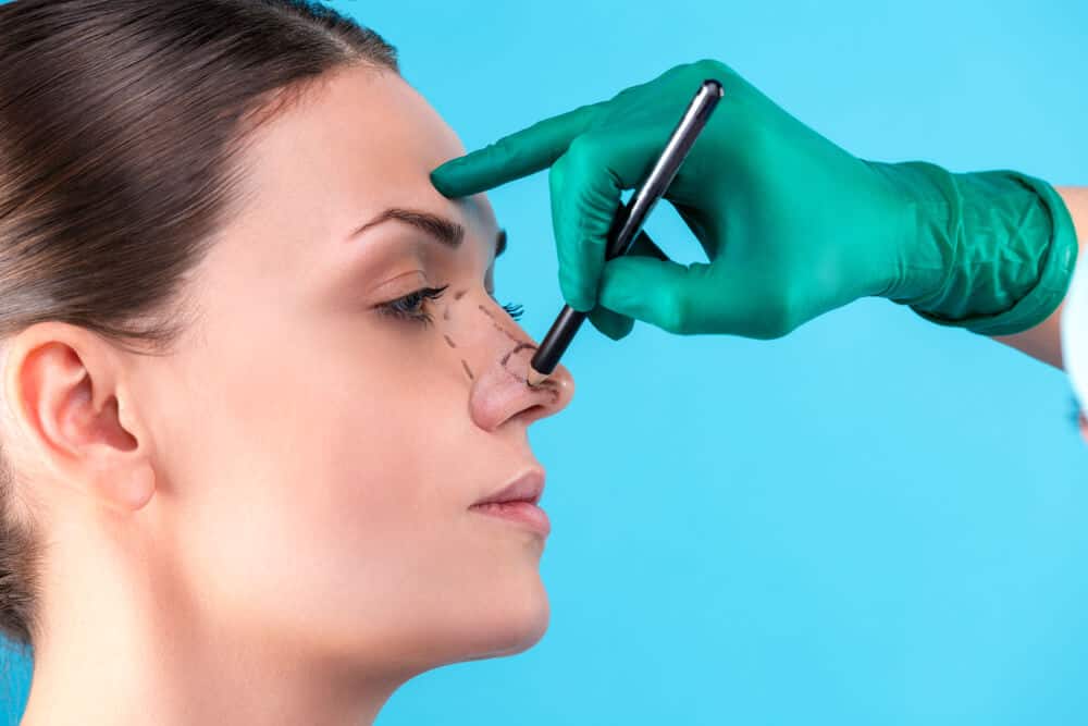 Rhinoplasty or Nose Job Loans and What To Expect